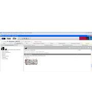 Установка Stakis technik 2018